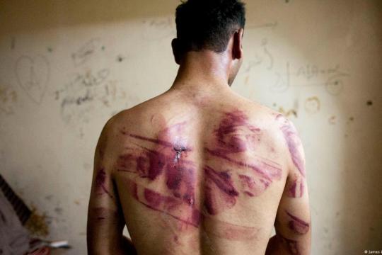تقرير حقوقي يوثق قيام عناصر النظام السوري بعمليات تصفية وتعذيب داخل مشفى تشرين العسكري