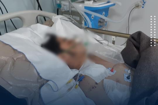 طبيب سوري لـ"نداء بوست": متلازمة الهرس قد تؤدي إلى توقُّف الكلى عن العمل